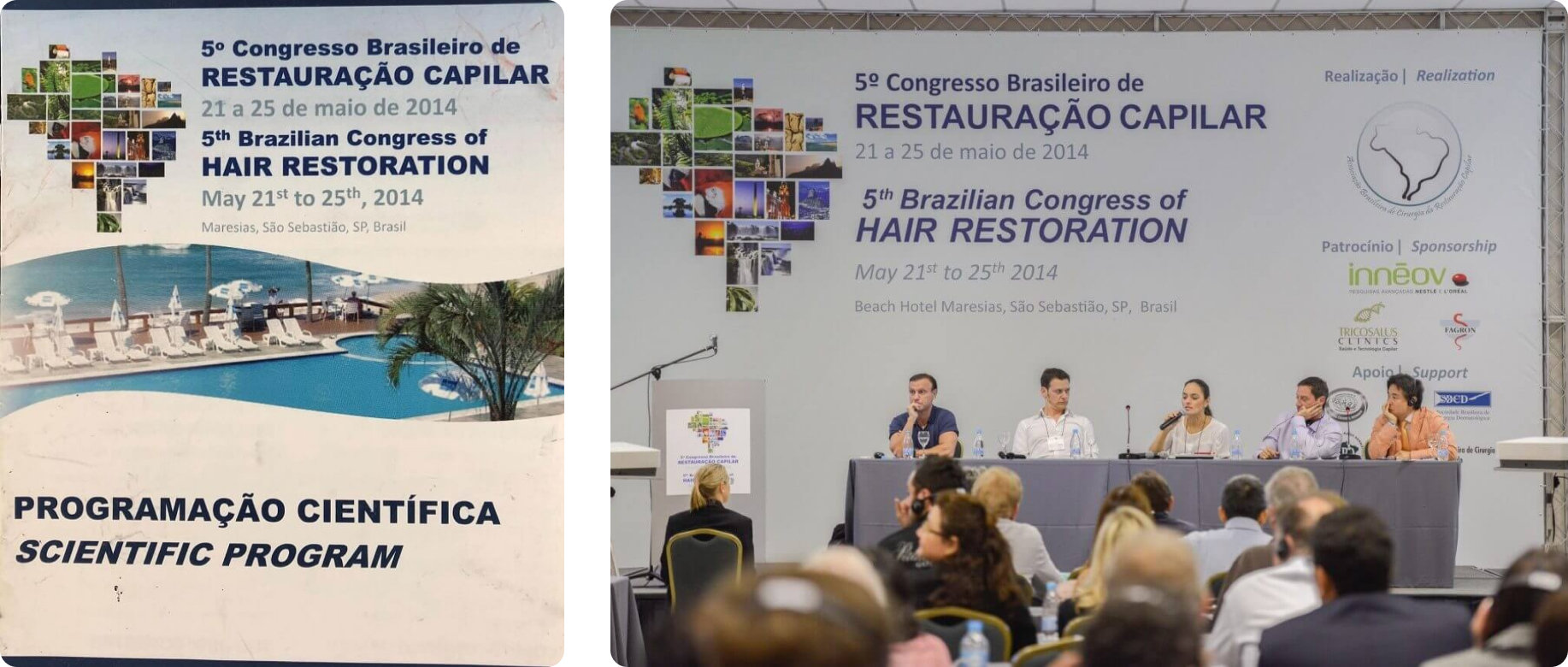 ブラジル ブラジル毛髪学会招待講演 「Hair Restoration with Robot Assist」
